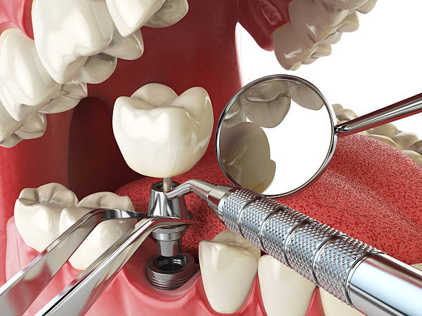 Best Walk-In Emergency Dental Services in Ptland, OR